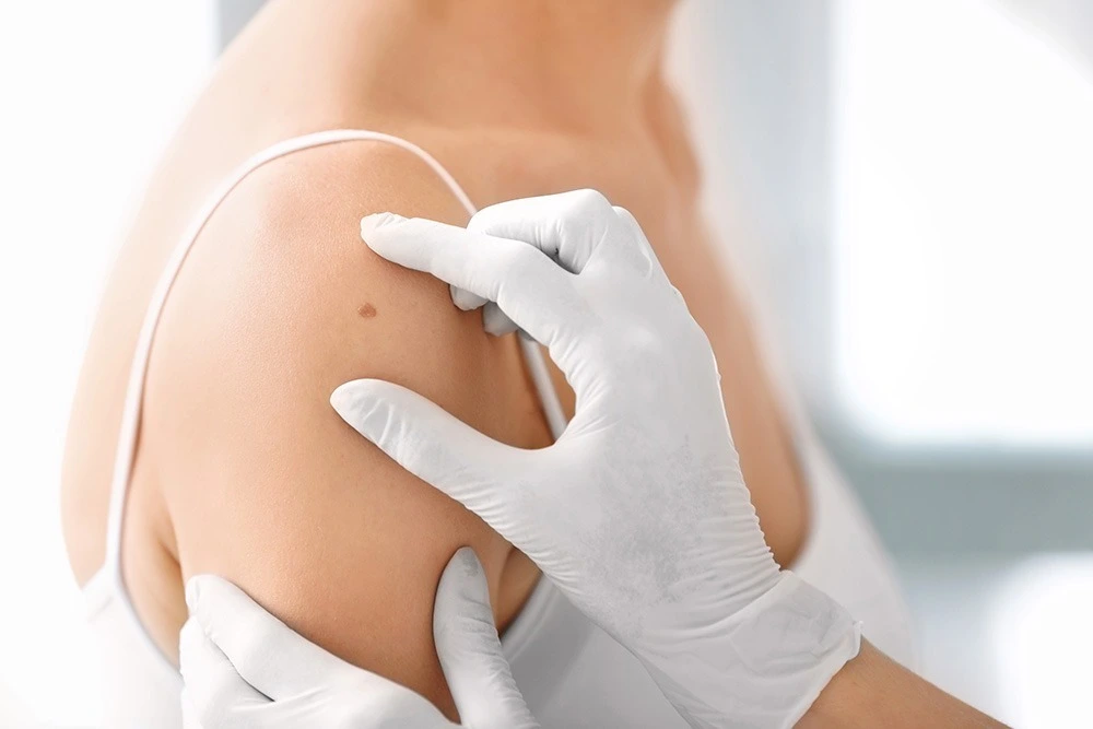 Dermatologie